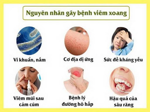 phuong-phap-bam-huyet-va-massage-cho-nguoi-viem-xoang-1